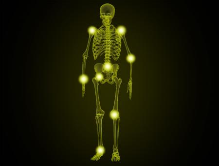 Painful Joints - Illustration