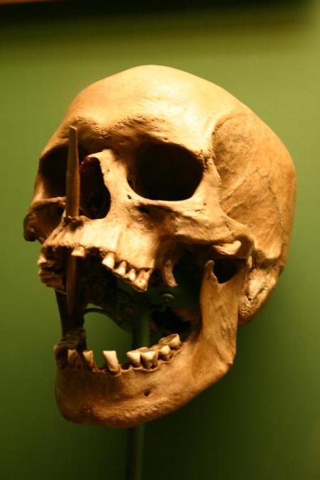 Skull