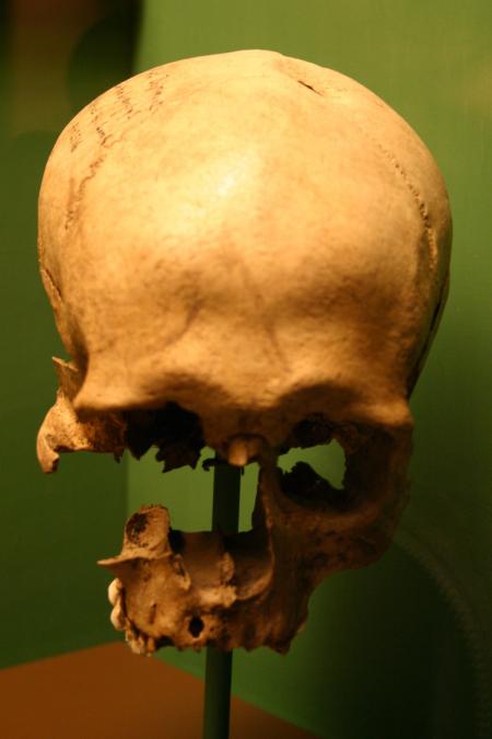 Skull