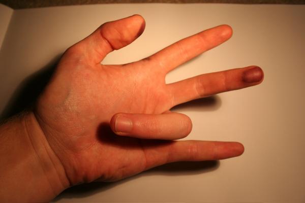 A hand