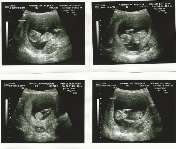 Alien Ultrasound