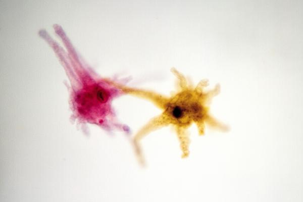 Amoeba