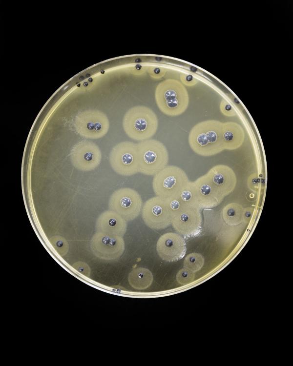 Bacteria growing on agar