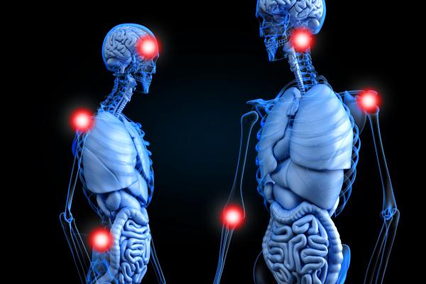 Chronic Pain Points - Painful Areas in the Human Body