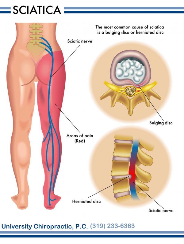 Chronic Pain Spots - Painful Joints in the Body