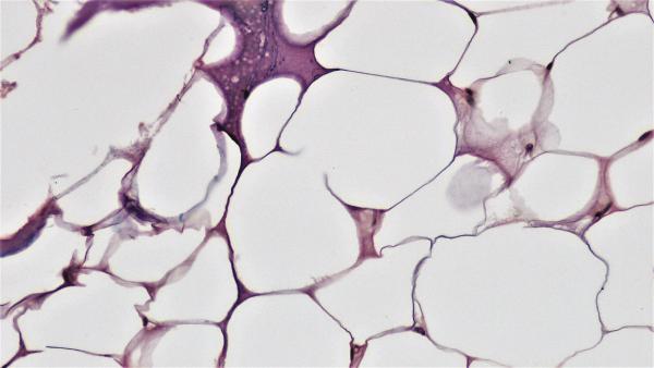 Connective Tissue: Adipose