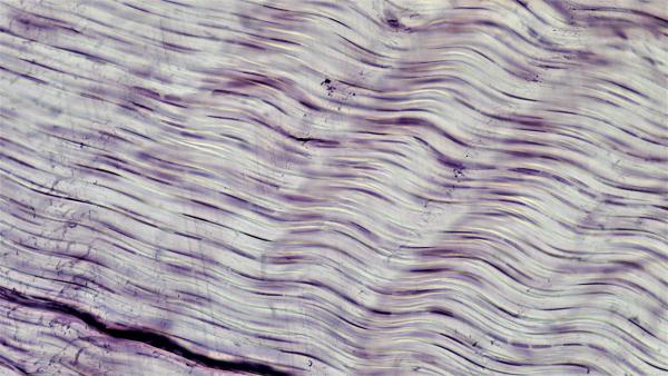 Connective Tissue: White Fibrous Connective