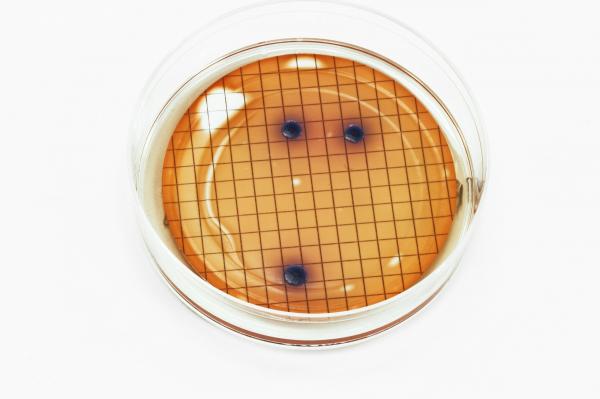 E. coli bacteria