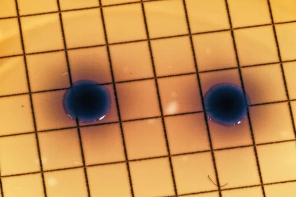 E. coli bacteria
