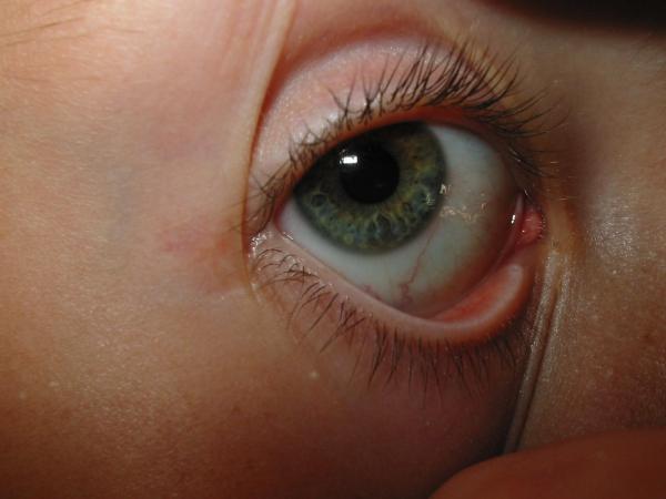 Eye