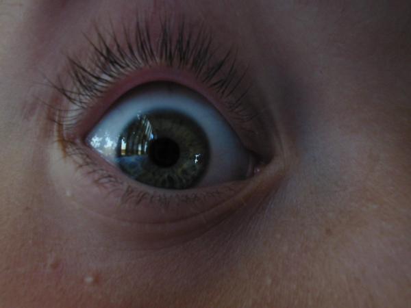 Eye