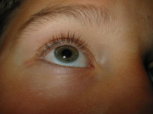 Eye