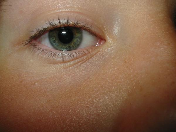 Eye