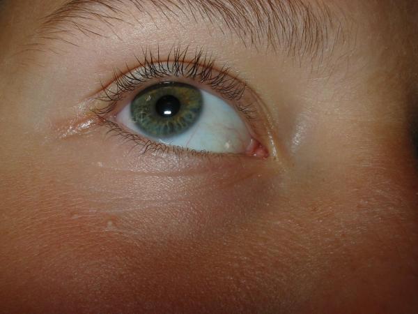 Eye