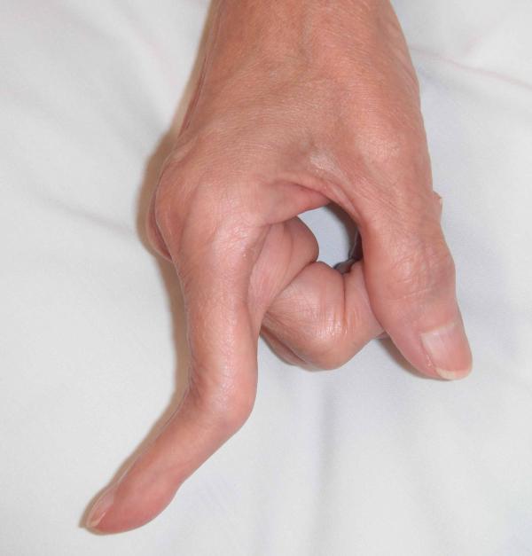 Fingers