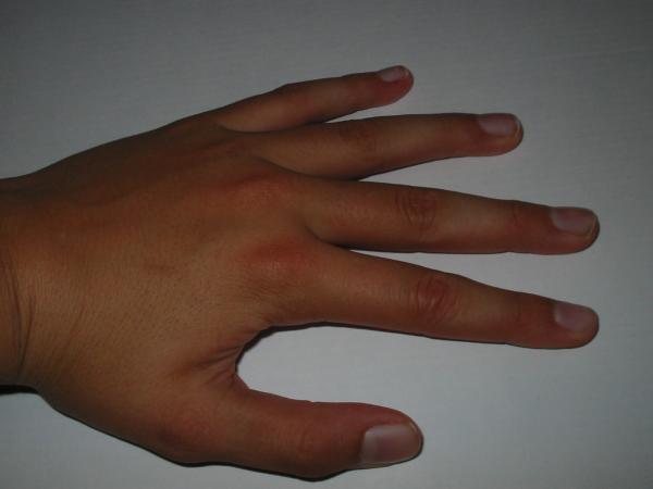 Hand