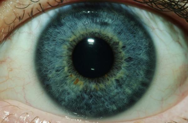 Iris