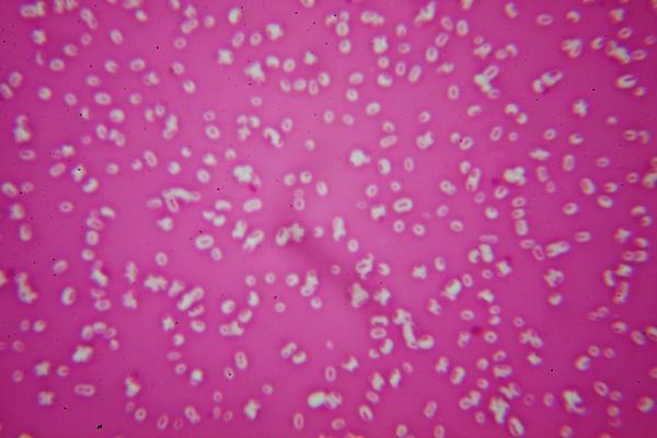 Klebsiella pneumoniae capsule stain