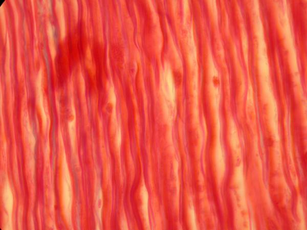 Muscle Tissue Texture