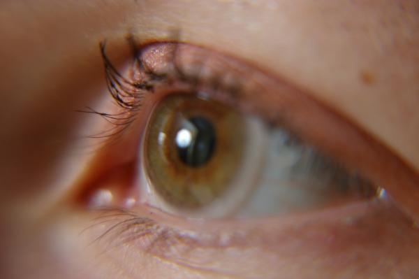 Open Eye
