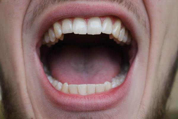 Open mouth