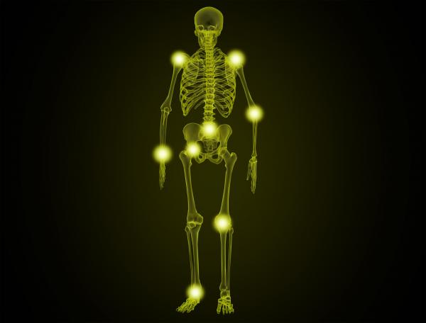 Painful Joints - Illustration