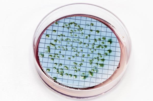 Pseudomonas bacteria on agar plate