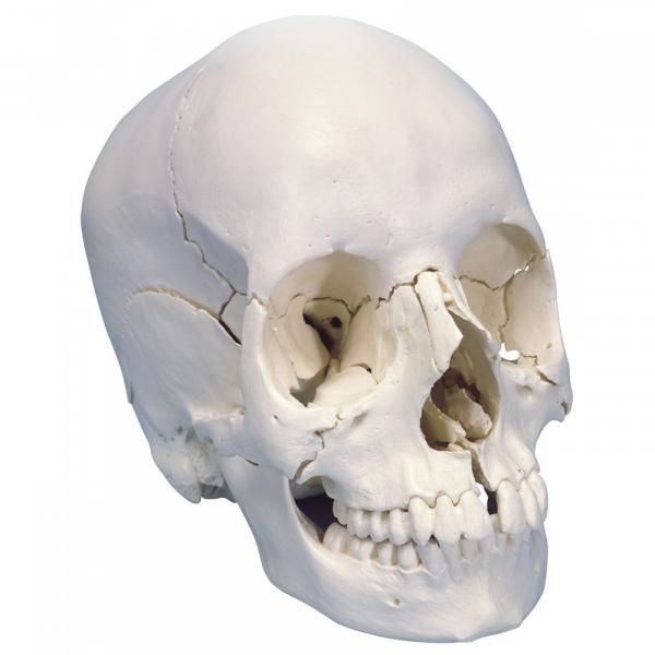 Skull