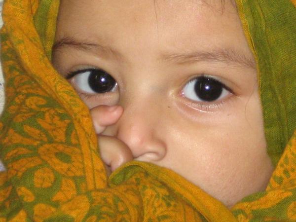 Starking eye
