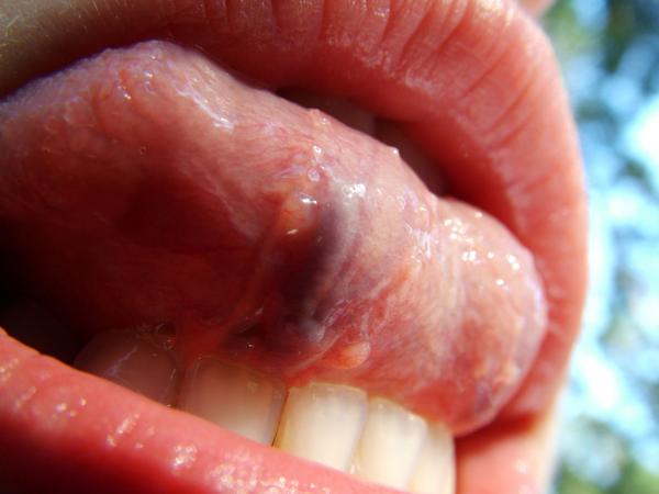 Toungue