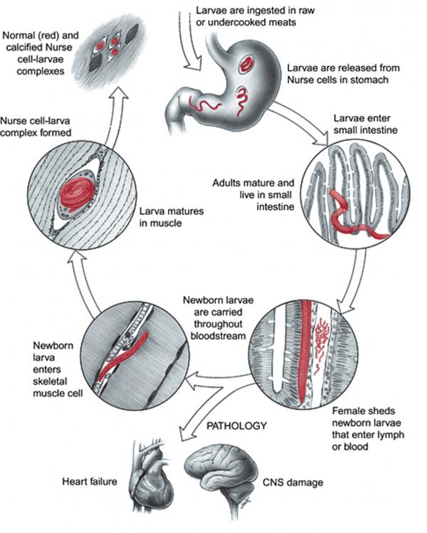 Trichinella spiralis